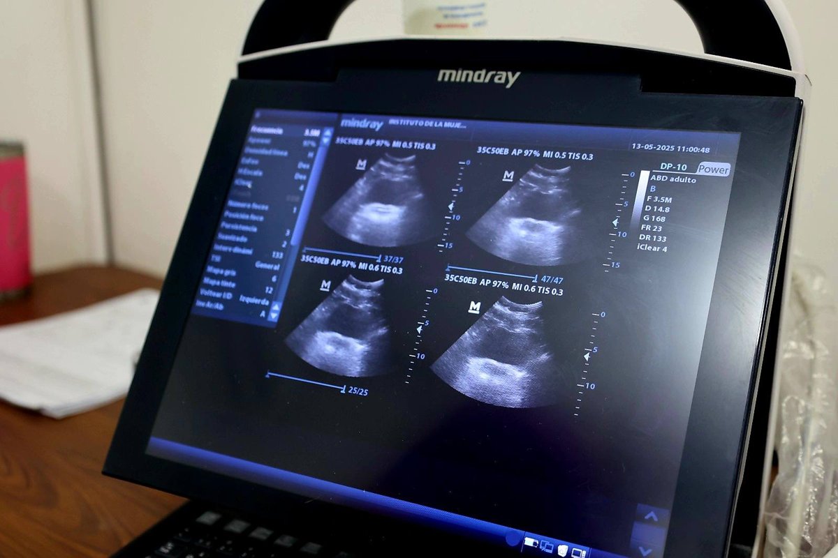 LA UNIDAD MÓVIL DEL IMEC BENEFICIA A 61 MUJERES CON SERVICIOS GRATUITOS EN LA LOCALIDAD DE MATAMOROS
