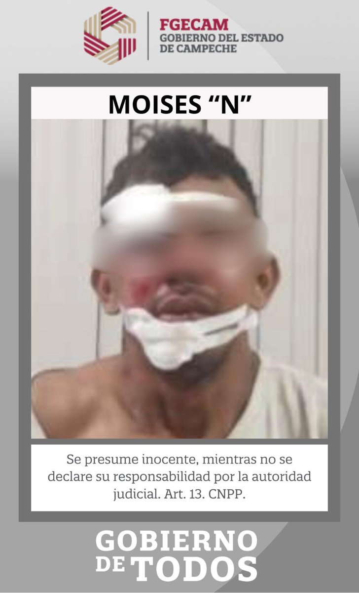 VINCULACIÓN A PROCESO POR ABUSO SEXUAL