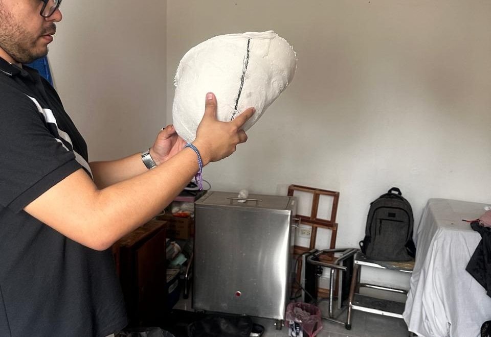 FORTALECEN AUTONOMÍA Y CALIDAD DE VIDA CON ENTREGA DE PRÓTESIS